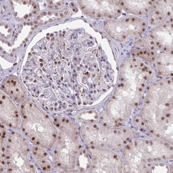 PRMT6 Antibody, Novus Biologicals:Antibodies:Primary Antibodies